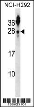 TSPAN2 Antibody (N-term)