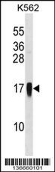 CCL7 Antibody (Center)