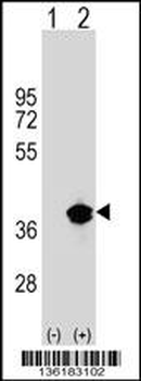 PPT1 Antibody (Center)