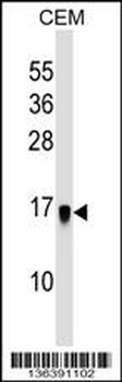 HSPC159 Antibody (Center)