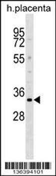 DOK5 Antibody (N-term)