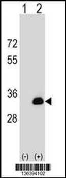 DOK5 Antibody (N-term)