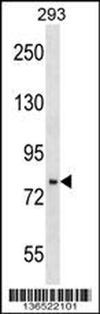 PHF16 Antibody (C-term)