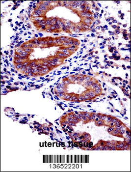 PHF16 Antibody (C-term)