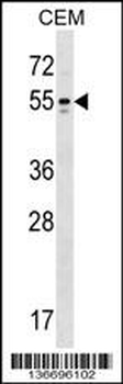 KCNA6 Antibody (N-term)