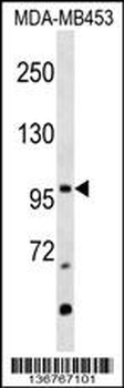 NR3C2 Antibody (Center)