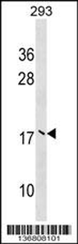 UBE2V2 Antibody (Center)