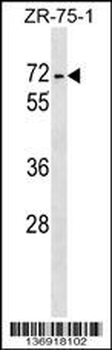 ZKSCAN1 Antibody (Center)