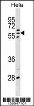 POLR3C Antibody (Center)