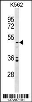 UST Antibody (C-term)