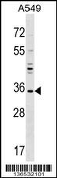 UNKL Antibody (N-term)