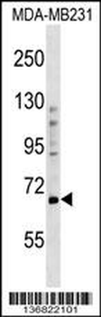 PRDM5 Antibody (N-term)