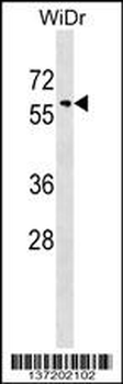 SNX18 Antibody (C-term)
