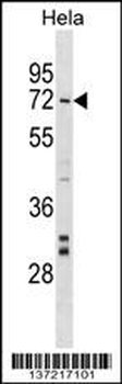NARF Antibody (Center)