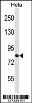 ZNF131 Antibody (Center)