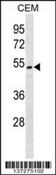ONECUT2 Antibody (N-term)