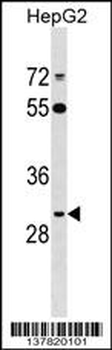 ARL10 Antibody (Center)