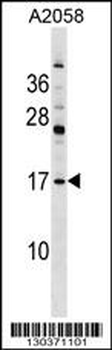PDE6D Antibody (Center)
