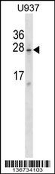 SRA1 Antibody (C-term)