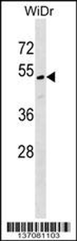 MLF1IP Antibody (C-term)