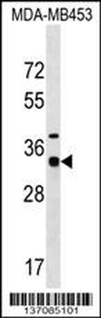 MYOZ2 Antibody (N-term)