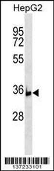 BRIX1 Antibody (C-term)