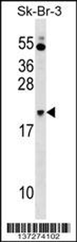 NKIRAS1 Antibody (Center)