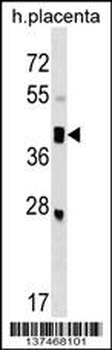 SMOC2 Antibody (C-term)