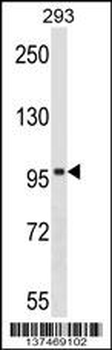 SPIRE1 Antibody (C-term)