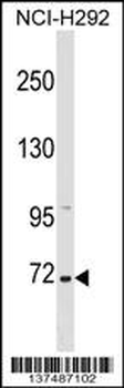 ZNF571 Antibody (N-term)