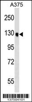 OSBPL6 Antibody (C-term)