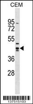 ZNF193 Antibody (Center)