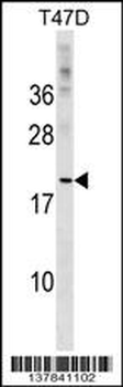 CLEC4D Antibody (Center)