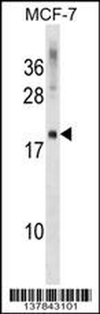 CMTM5 Antibody (Center)