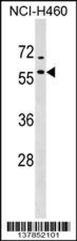 DNAJA4 Antibody (C-term)
