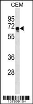 FEM1C Antibody (C-term)