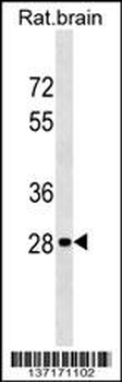 Rat Hoxd9 Antibody (Center)