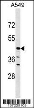 ELAC1 Antibody (N-term)