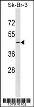 QTRT1 Antibody (C-term)
