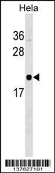 RWDD1 Antibody (N-term)