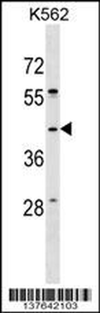 SPO11 Antibody (C-term)