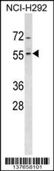 ZNF200 Antibody (Center)