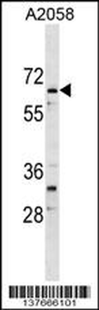 ARID5A Antibody (Center)