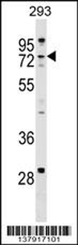 ZCCHC8 Antibody (C-term)
