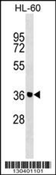 ZNF785 Antibody (N-term)
