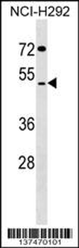 SUDS3 Antibody (N-term)