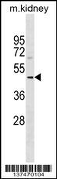 SUDS3 Antibody (N-term)