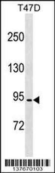 CCDC66 Antibody (C-term)