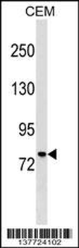 MUM1 Antibody (C-term)