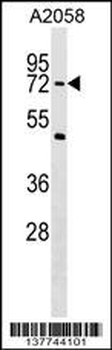 PHF19 Antibody (C-term)